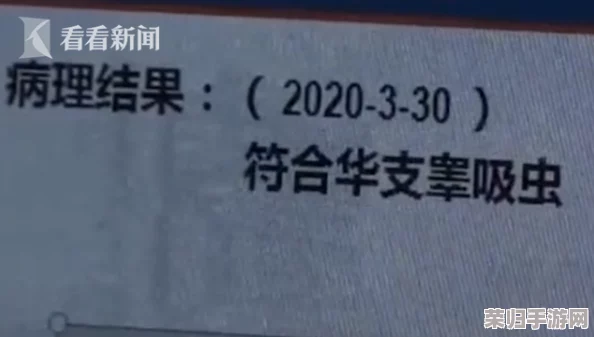 毛茸茸妇女体内汇编:探寻自然之美,感受生命的奇迹 毛茸茸妇女体内汇编:探寻自然之美,感受生命的奇迹
